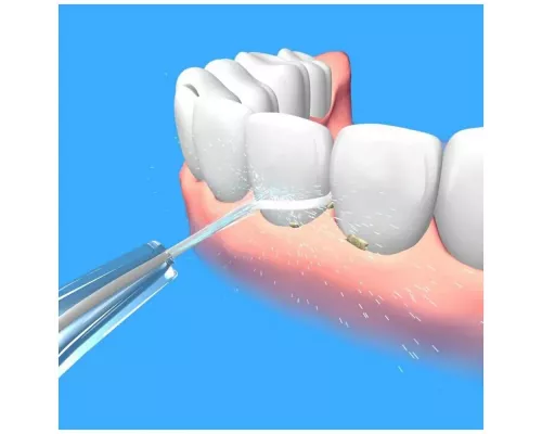 Ирригатор JETPIK JP50 Star